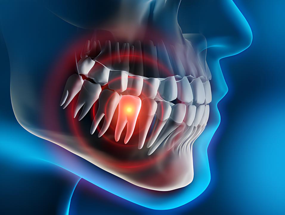 Teeth image - Emergency dentist Marlow